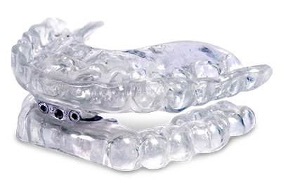 Oral Appliance mouth piece